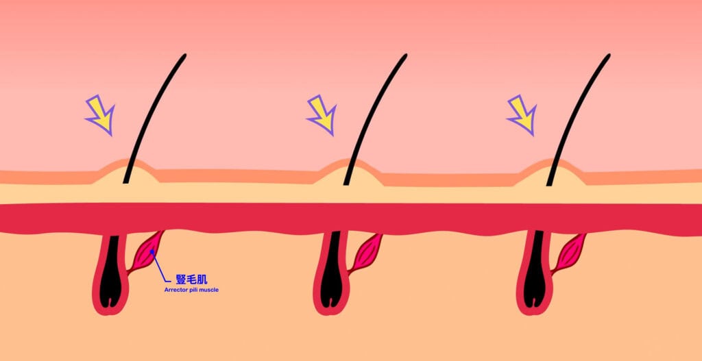 音樂
雞皮疙瘩
原理
豎毛肌