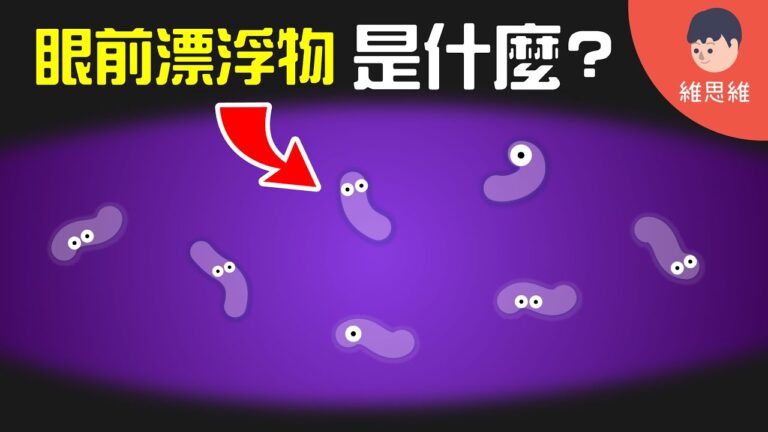 飛蚊症，眼睛，浮游物是什麼